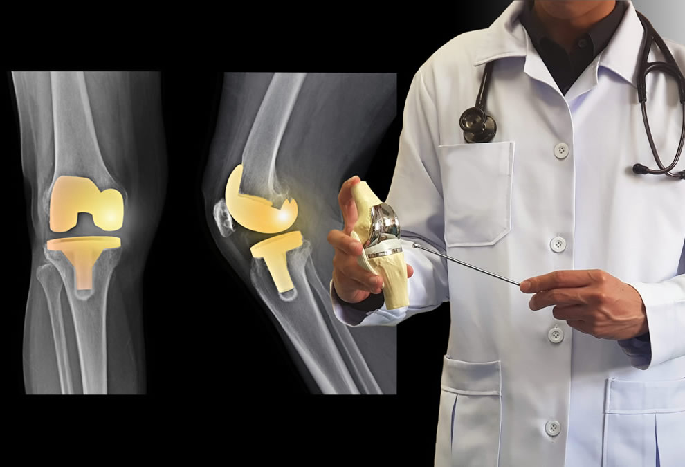 Total knee replacement surgeon in Goregaon